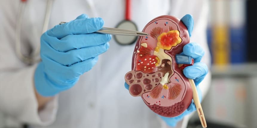 Piedras en la vías urinarias